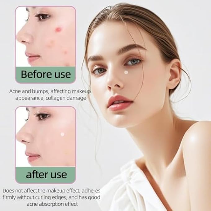 STRBOXONG ACNE PIMPLE PATCHES FOR FACE, SKIN CONTROL PIMPLE PATCH,HYDROCOLLOID PIMPLE PATCH FOR COVERING ZITS AND BLEMISHES,SPOT STICKERS FOR FACE AND SKIN(180 COUNT) - Image 2